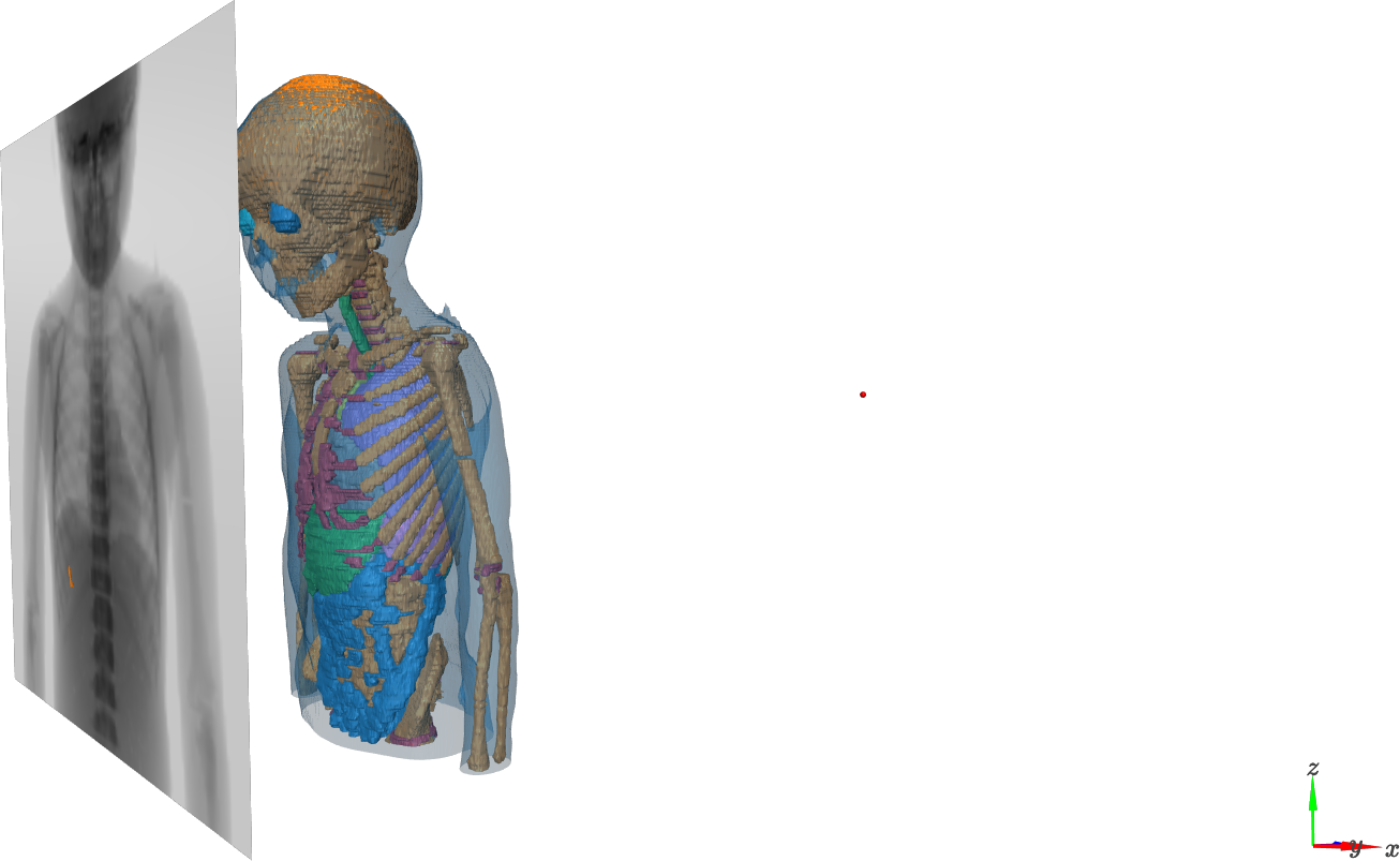 ../../_images/demos_CBCT-acquisition-with-noise-and-reconstruction_38_0.png